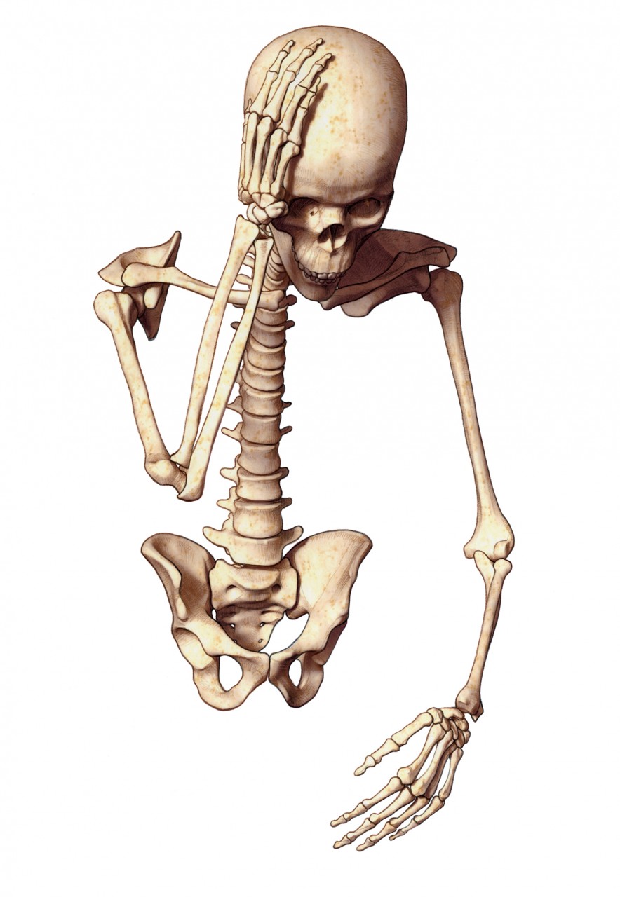 Skeleton with headache