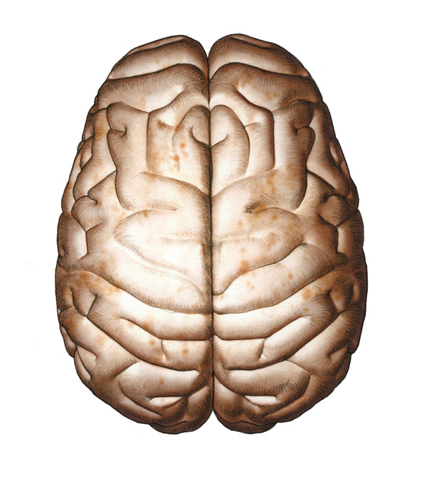 No alt text available